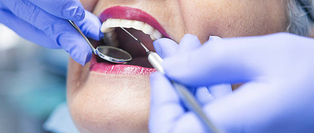 Best Emergency Root Canal Therapy in Sealy, TX